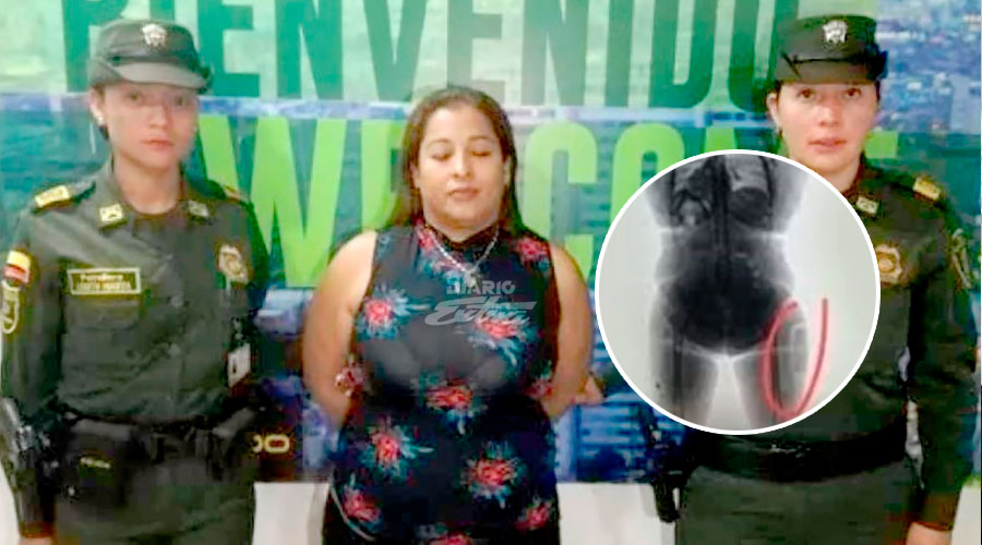 ALERTA AEROPUERTO: Una mujer se implanta cocaína líquida en los muslos para transportarla a España y la pillan en el aeropuerto de Bogotá