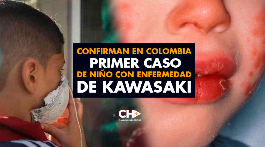 Confirman en Colombia PRIMER CASO de niño con enfermedad de KAWASAKI