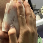 Condenaron a agente del antiguo ESMAD por dispararle a una joven y quitarle la visión en un ojo