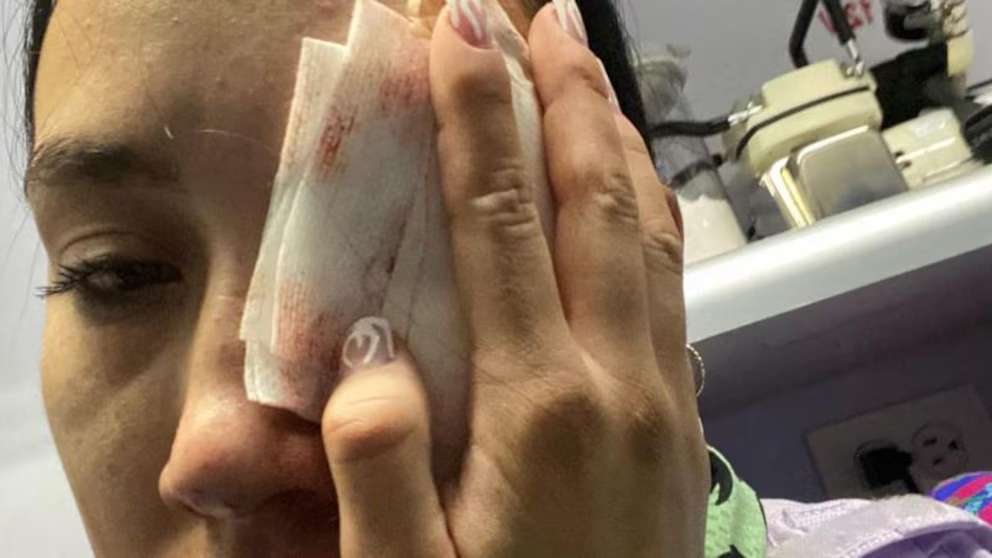 Condenaron a agente del antiguo ESMAD por dispararle a una joven y quitarle la visión en un ojo